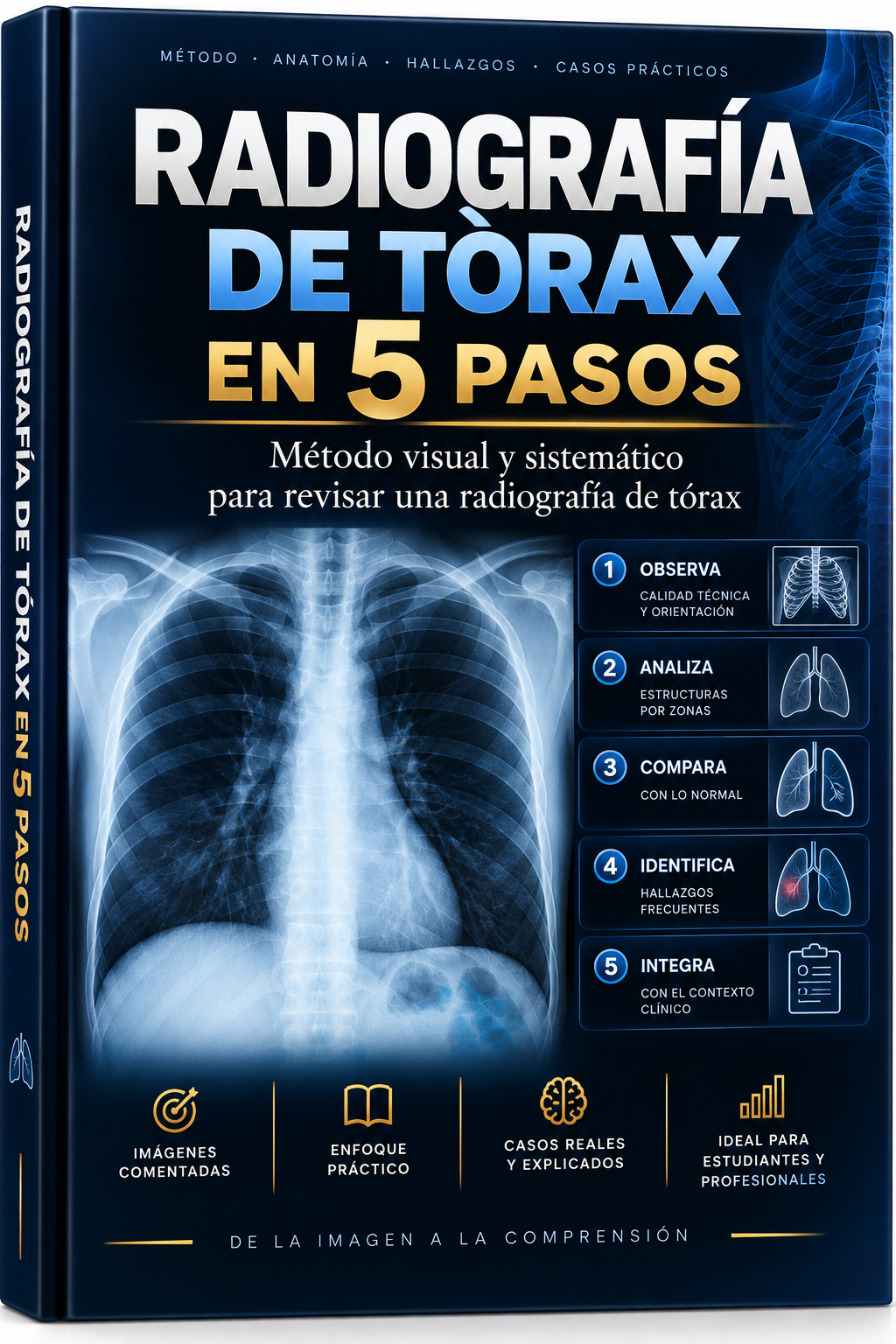 Portada del bono Radiografía de Tórax en 5 Pasos